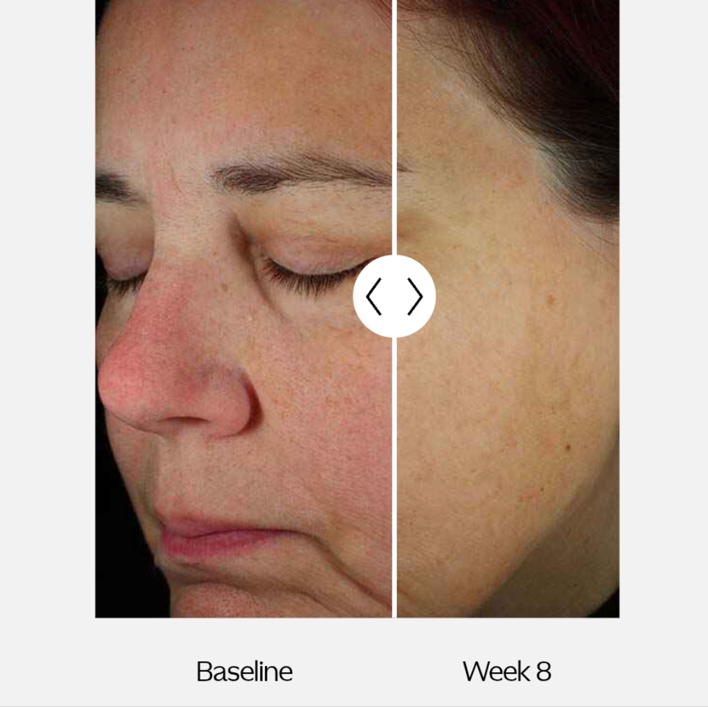 ZO SKIN HEALTH by ZEIN OBAJI sheet masks - Picture 9 of 9